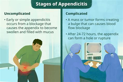 What happens if your appendix bursts while sleeping?